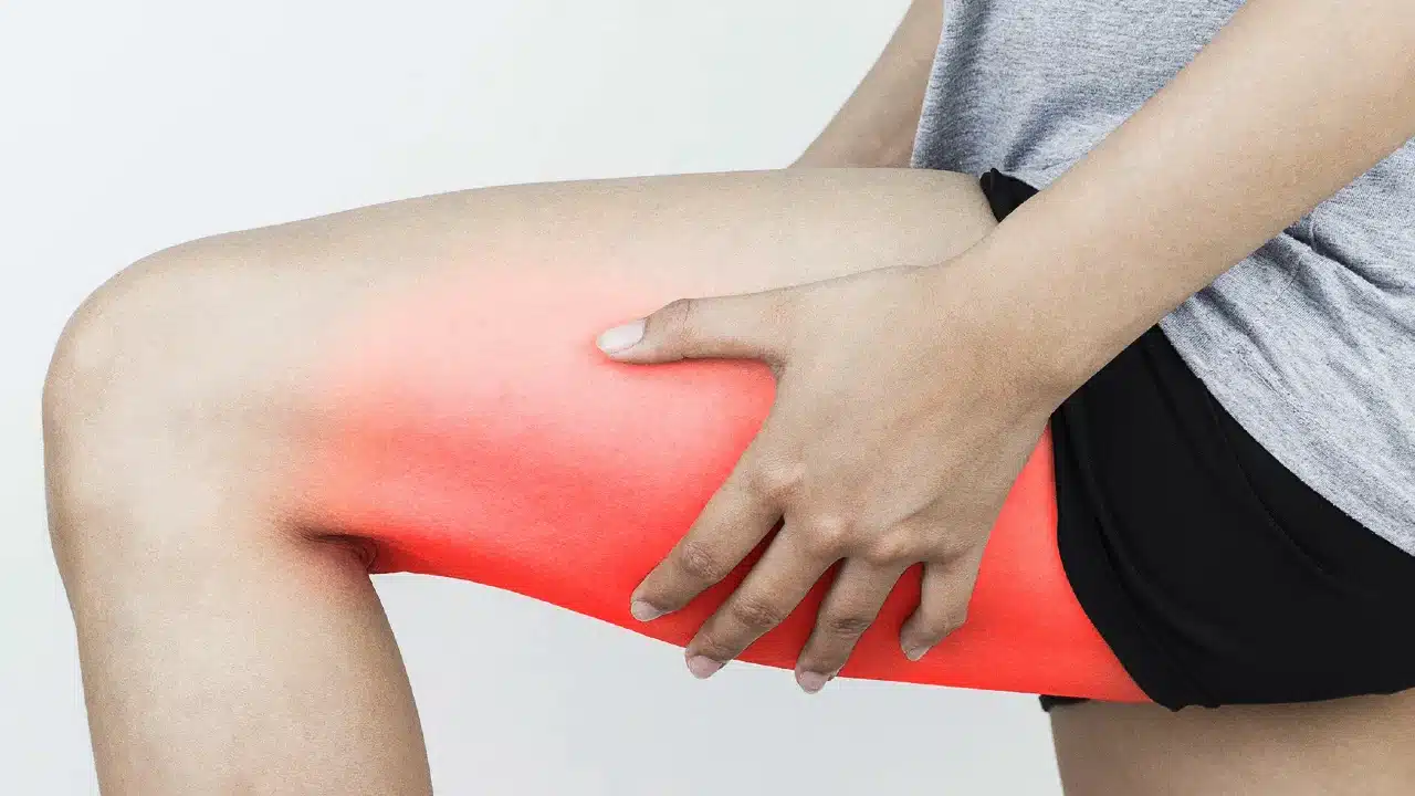 Lipödem nedir, obezite ile farkı ne? Ağrılı bacak sendromu için anti-inflamatuar diyet ve düşük karbonhidratlı beslenme önerileri.