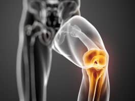 Robotik diz cerrahisi: Total diz protezi, diz protezi ömrü ve ameliyat sonrası iyileşme süreci üzerine bir konsept.