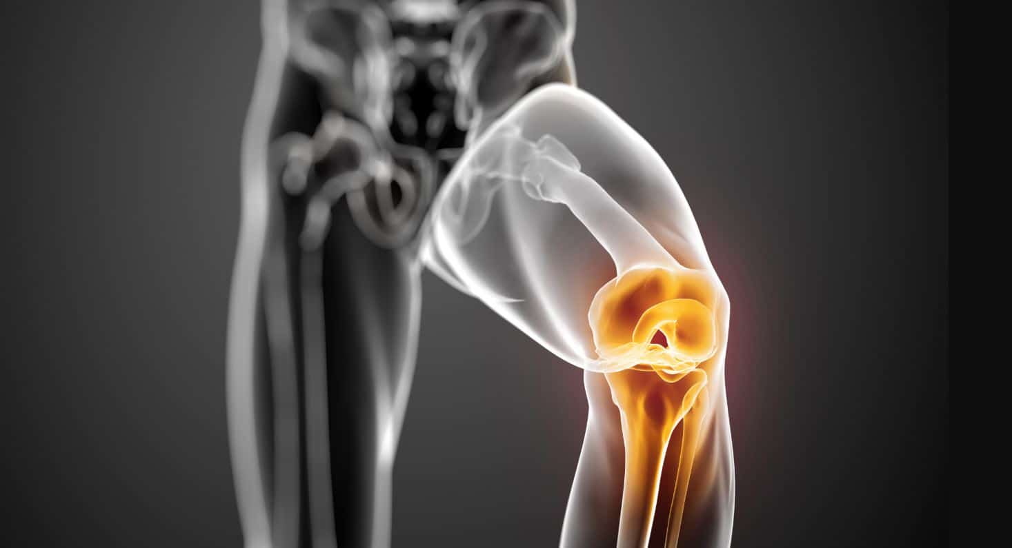 Robotik diz cerrahisi: Total diz protezi, diz protezi ömrü ve ameliyat sonrası iyileşme süreci üzerine bir konsept.