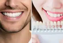Titanyum mu zirkonyum mu? Diş implantı malzemeleri, kemik ogmentasyonu ve peri-implantitis riskleri üzerine bir konsept.