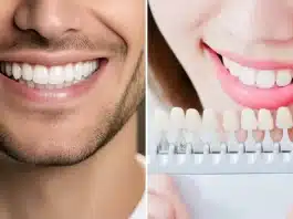 Titanyum mu zirkonyum mu? Diş implantı malzemeleri, kemik ogmentasyonu ve peri-implantitis riskleri üzerine bir konsept.