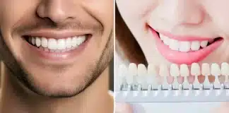 Titanyum mu zirkonyum mu? Diş implantı malzemeleri, kemik ogmentasyonu ve peri-implantitis riskleri üzerine bir konsept.