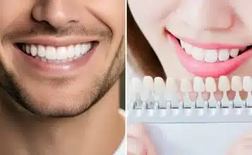 Titanyum mu zirkonyum mu? Diş implantı malzemeleri, kemik ogmentasyonu ve peri-implantitis riskleri üzerine bir konsept.
