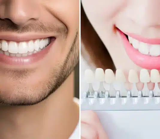 Titanyum mu zirkonyum mu? Diş implantı malzemeleri, kemik ogmentasyonu ve peri-implantitis riskleri üzerine bir konsept.