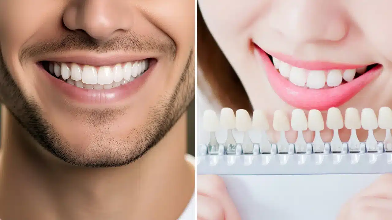 Titanyum mu zirkonyum mu? Diş implantı malzemeleri, kemik ogmentasyonu ve peri-implantitis riskleri üzerine bir konsept.