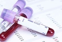 Aile hekiminde vitamin eksikliği testi yapılır mı? D vitamini eksikliği gibi vitamin eksikliği belirtileri ve aşırı vitamin alımı riskleri.