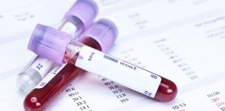 Aile hekiminde vitamin eksikliği testi yapılır mı? D vitamini eksikliği gibi vitamin eksikliği belirtileri ve aşırı vitamin alımı riskleri.