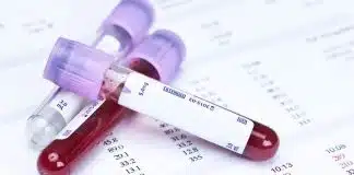 Aile hekiminde vitamin eksikliği testi yaptırılır mı? Aile hekiminde vitamin eksikliği testi yapılır mı? D vitamini eksikliği gibi vitamin eksikliği belirtileri ve aşırı vitamin alımı riskleri.