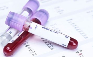 Aile hekiminde vitamin eksikliği testi yapılır mı? D vitamini eksikliği gibi vitamin eksikliği belirtileri ve aşırı vitamin alımı riskleri.