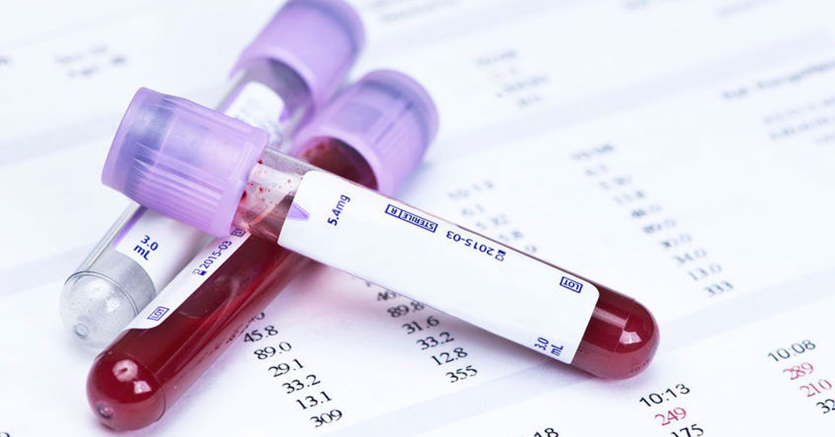 Aile hekiminde vitamin eksikliği testi yapılır mı? D vitamini eksikliği gibi vitamin eksikliği belirtileri ve aşırı vitamin alımı riskleri.
