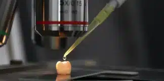 Diş minesini onaran jel: Diş çürükleri ve mine aşınmasına karşı geliştirilen yeni protein iskelesi teknolojisi.