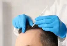 Kök Hücre Destekli Saç Ekimi: Farkı, Avantajları ve Sonuçları Kök hücre saç ekimi: Avantajları, saç köklerinin tutunma oranı ve saç ekimi sonrası iyileşme süreci.