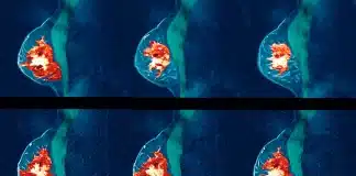 Meme kanserinden korunmak mümkün mü? Risk faktörleri, erken tanı yöntemleri ve kendi kendine meme muayenesi adımları.