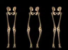 Raşitizm nedir ve belirtileri nelerdir: Çocuklarda sağlıklı kemik gelişimi ve D vitamini önemi.