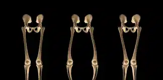 Raşitizm Hakkında Bilinmesi Gerekenler Raşitizm nedir ve belirtileri nelerdir: Çocuklarda sağlıklı kemik gelişimi ve D vitamini önemi.