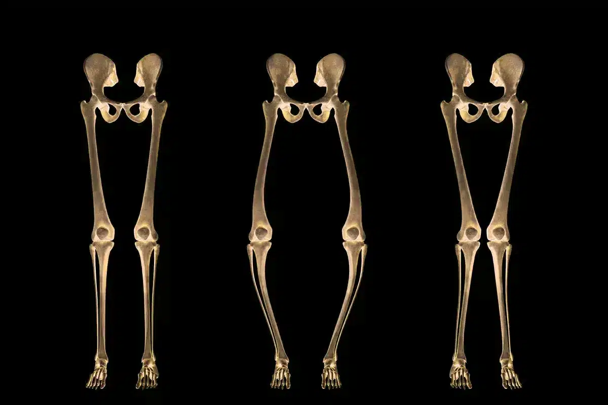 Raşitizm Hakkında Bilinmesi Gerekenler