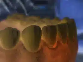 Diş eti yanması ve ağrısı neden olur? Ağız sağlığını tehdit eden gizli faktörler! Diş eti yanması ve ağrısı yaşayan bir hastanın diş hekimi muayenesi görseli.