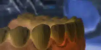 Diş eti yanması ve ağrısı neden olur? Ağız sağlığını tehdit eden gizli faktörler! Diş eti yanması ve ağrısı yaşayan bir hastanın diş hekimi muayenesi görseli.