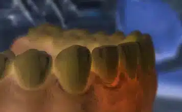 Diş eti yanması ve ağrısı neden olur? Ağız sağlığını tehdit eden gizli faktörler! Diş eti yanması ve ağrısı yaşayan bir hastanın diş hekimi muayenesi görseli.