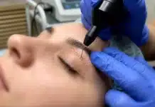 Plexr lazer ile ameliyatsız göz kapağı estetiği hakkında her şey Uzman doktor tarafından uygulanan ameliyatsız göz kapağı estetiği işlemi. Plexr lazer tedavisi