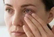 Demodex paraziti: Göz kuruluğu ve gözyaşı dengesi üzerindeki bozucu etkisi Demodex paraziti kaynaklı kirpik dibi iltihabı ve kepeklenme belirtileri