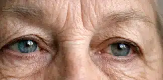 Görme kaybı Alzheimer habercisi mi? Göz muayenesinde saklı ipuçları Alzheimer göz sağlığı Görme kaybı Alzheimer habercisi mi? Göz muayenesinde saklı ipuçları
