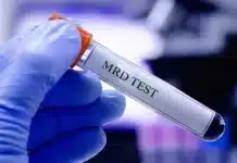 Kanser MRD testi gizli hücreleri tespit ediyor: Nüks riski erken belirleniyor Kanser MRD testi ile kanda hücre analizi