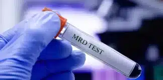 Kanser MRD testi gizli hücreleri tespit ediyor: Nüks riski erken belirleniyor Kanser MRD testi ile kanda hücre analizi