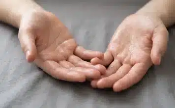 Aşırı terleme neden olur: Fiziksel aktivite olmadan terlemenin altında yatan nedenler Aşırı terleme nedenleri ve ter bezlerinin çalışma mekanizması