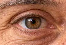 Düz çizgiler kırık görünüyorsa dikkat: Sarı nokta hastalığı erken evrede nasıl anlaşılır? Sarı nokta hastalığı retina muayenesi ve merkezi görme analizi