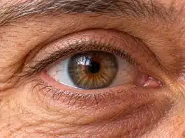 Düz çizgiler kırık görünüyorsa dikkat: Sarı nokta hastalığı erken evrede nasıl anlaşılır? Sarı nokta hastalığı retina muayenesi ve merkezi görme analizi