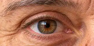 Düz çizgiler kırık görünüyorsa dikkat: Sarı nokta hastalığı erken evrede nasıl anlaşılır? Sarı nokta hastalığı retina muayenesi ve merkezi görme analizi