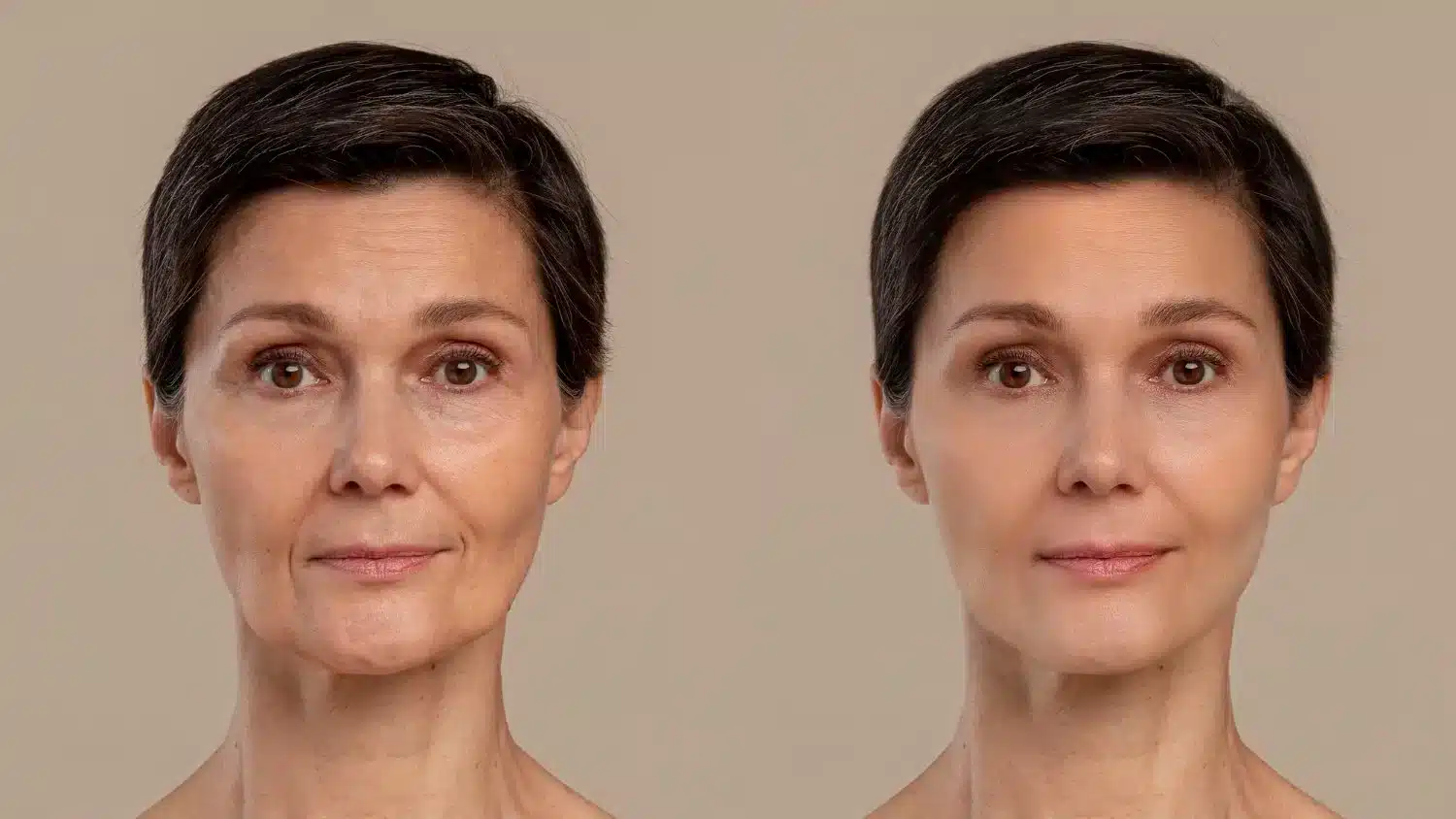 zayıflama iğnesi ozempic face