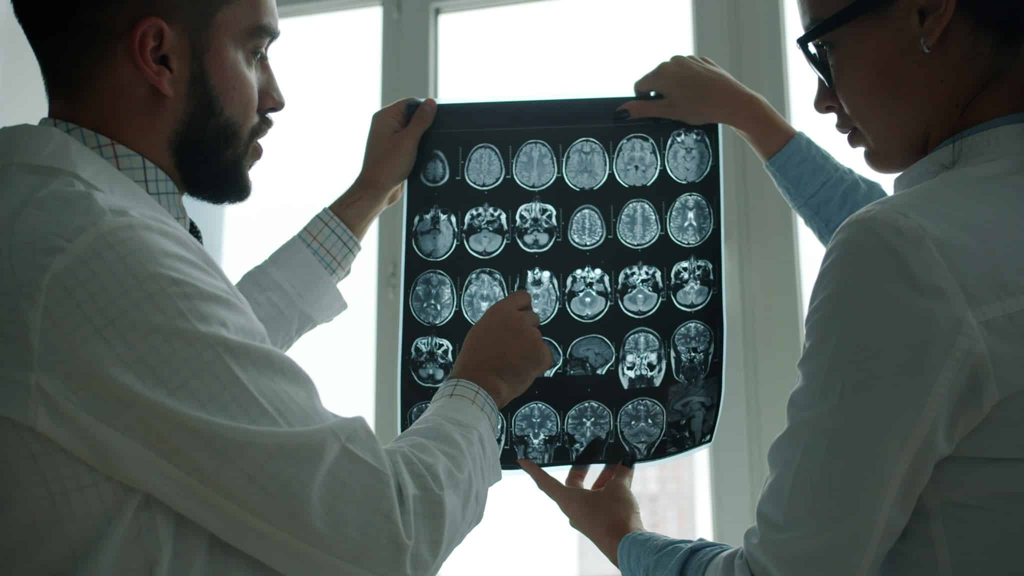 Beyin tümörü şüphesinde MR görüntülerini inceleyen doktorlar