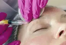 Botoks direnci nedir? Botoks artık tutmuyorsa nedeni ilaç olmayabilir Botoks direnci riskine karşı alın bölgesine kontrollü dozda botoks enjeksiyonu yapılan bir kişi