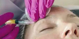 Botoks direnci nedir? Botoks artık tutmuyorsa nedeni ilaç olmayabilir Botoks direnci riskine karşı alın bölgesine kontrollü dozda botoks enjeksiyonu yapılan bir kişi