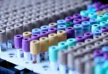 Cinsel yolla bulaşan hastalıklar: Sessiz enfeksiyonlara dikkat Laboratuvarda kan tüpleri, cinsel yolla bulaşan hastalıklar için test ve tarama