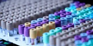 Cinsel yolla bulaşan hastalıklar: Sessiz enfeksiyonlara dikkat Laboratuvarda kan tüpleri, cinsel yolla bulaşan hastalıklar için test ve tarama