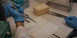 Laboratuvarda pipetle çalışan araştırmacı, damar tıkanıklığı ve Toxoplasma araştırması