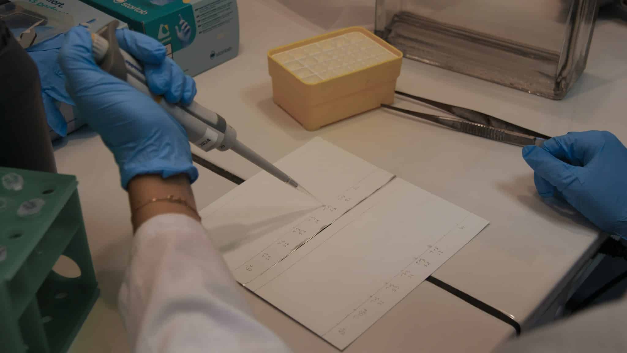 Laboratuvarda pipetle çalışan araştırmacı, damar tıkanıklığı ve Toxoplasma araştırması