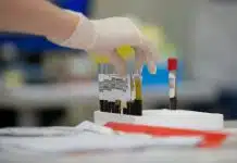Hepatit hakkında doğru bilinen 11 yanlış Hepatit taraması için alınan kan örneğini tutan eldivenli bir el
