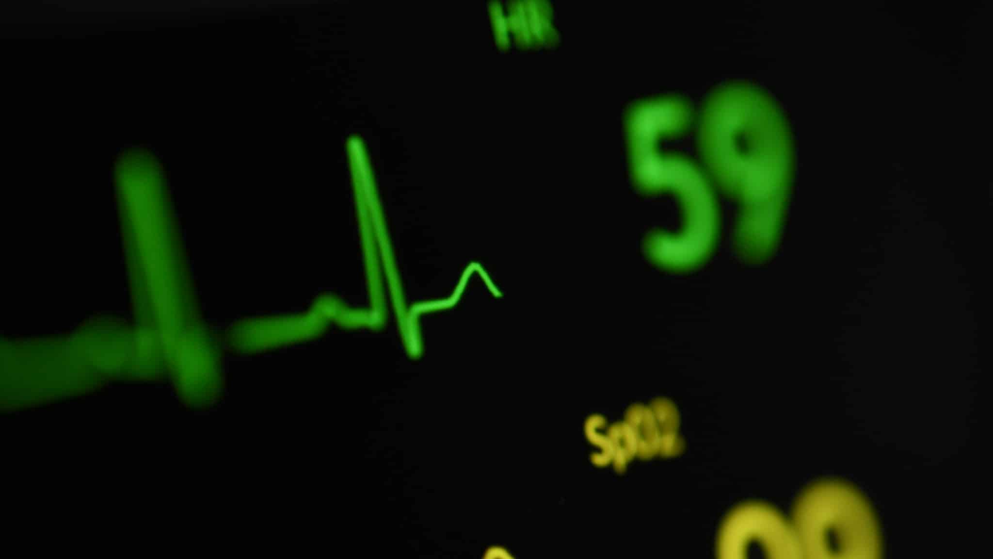 Monitörde kalp ritmi grafiği ve nabız değeri; kalp çarpıntısı bazen ritim bozukluğunun habercisi olabiliyor