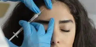 Koruyucu botoks gerçekten koruyor mu? Asıl kriter çizgi tipi Koruyucu botoks uygulamasında hekimin genç bir hastanın alın bölgesine düşük dozda enjeksiyon yapması