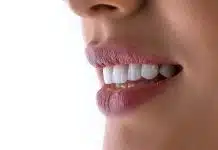 Diş beyazlatma mineye zarar verir mi? Sağlıklı beyazlatma için 7 öneri Diş beyazlatma sonrası beyaz dişleri görünen gülümseyen bir kadının yakın plan ağzı