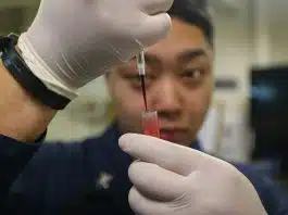Sıvı biyopsi nedir? Kandaki tümör DNA’sı kanser takibini nasıl değiştiriyor? Sıvı biyopsi için laboratuvarda tüpe örnek aktaran eldivenli eller